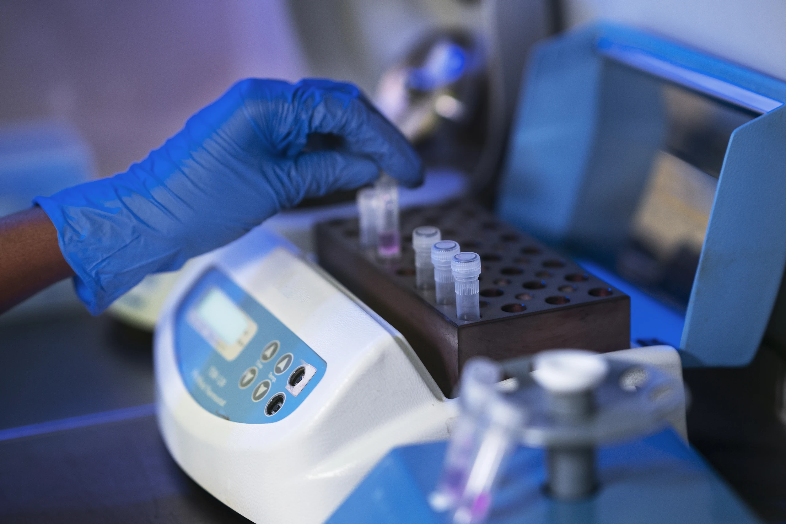 Mycoplasma Detection in the Lab